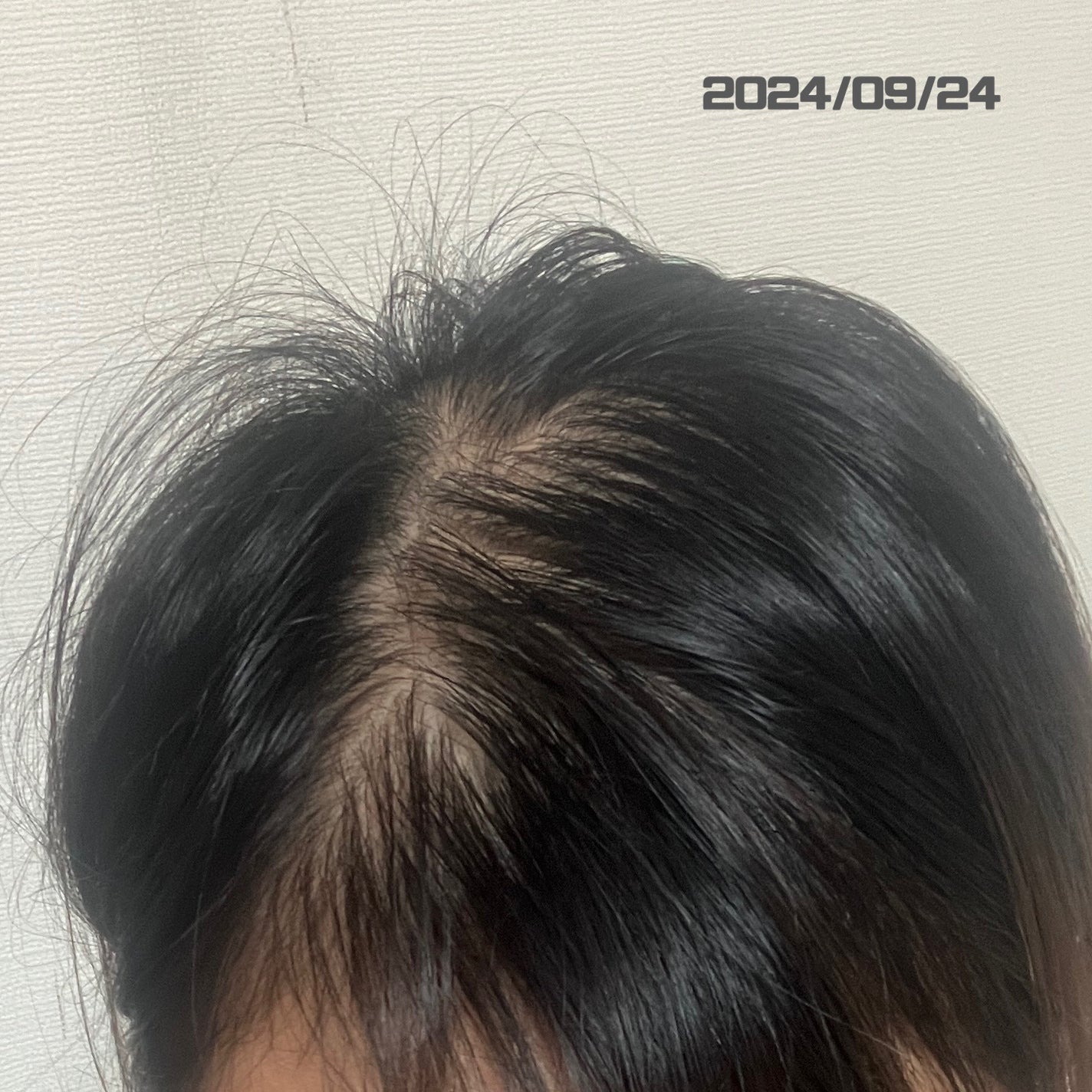 育毛エッセンス/セグレタ/頭皮ローションを使ったクチコミ(3枚目)