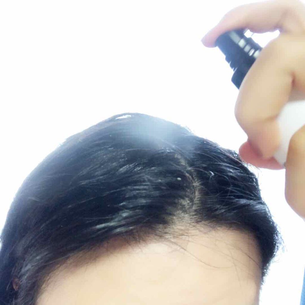 アストニッシュ スカルプナノミスト/クリニックエディション/頭皮ローションを使ったクチコミ（2枚目）