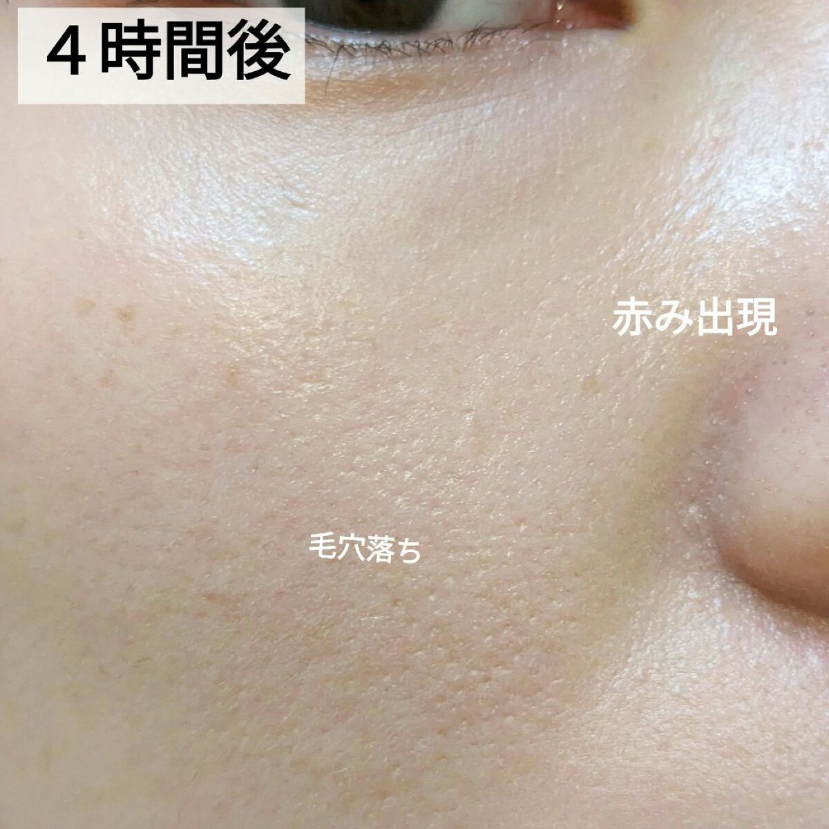 エッセンスBBクリーム ML(モイストリフト) 33g/毛穴パテ職人/BBクリームを使ったクチコミ（3枚目）