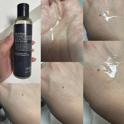 スネイルビー アルティメット トナー 150ml/BENTON/化粧水を使ったクチコミ(7枚目)