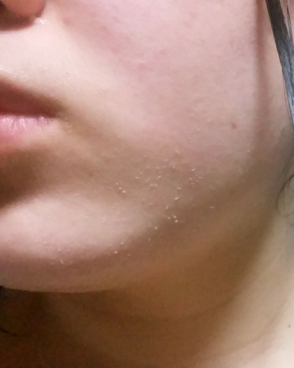 ハトムギエキスピーリングジェル/プラチナレーベル/ピーリングを使ったクチコミ(4枚目)