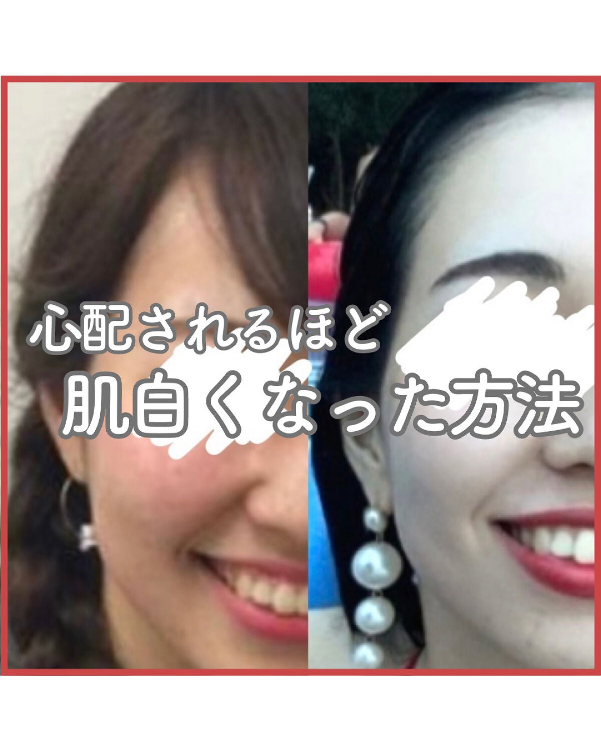 ビタミンC「2000」(医薬品)/武田薬品工業/健康サプリメントを使ったクチコミ(1枚目)