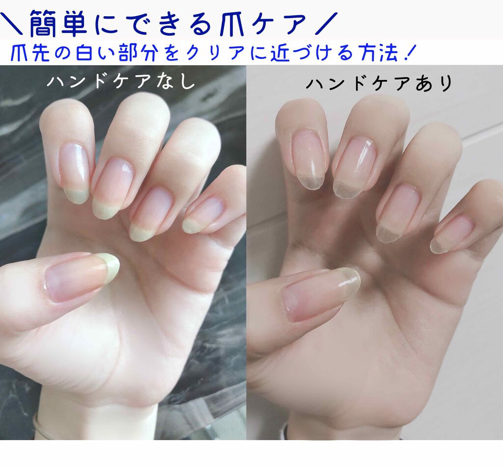 クイックケアコート Ettusaisの口コミ 簡単にできる爪ケア 爪先の白い部分をクリアに近づける方法 By Liii 代前半 Lips