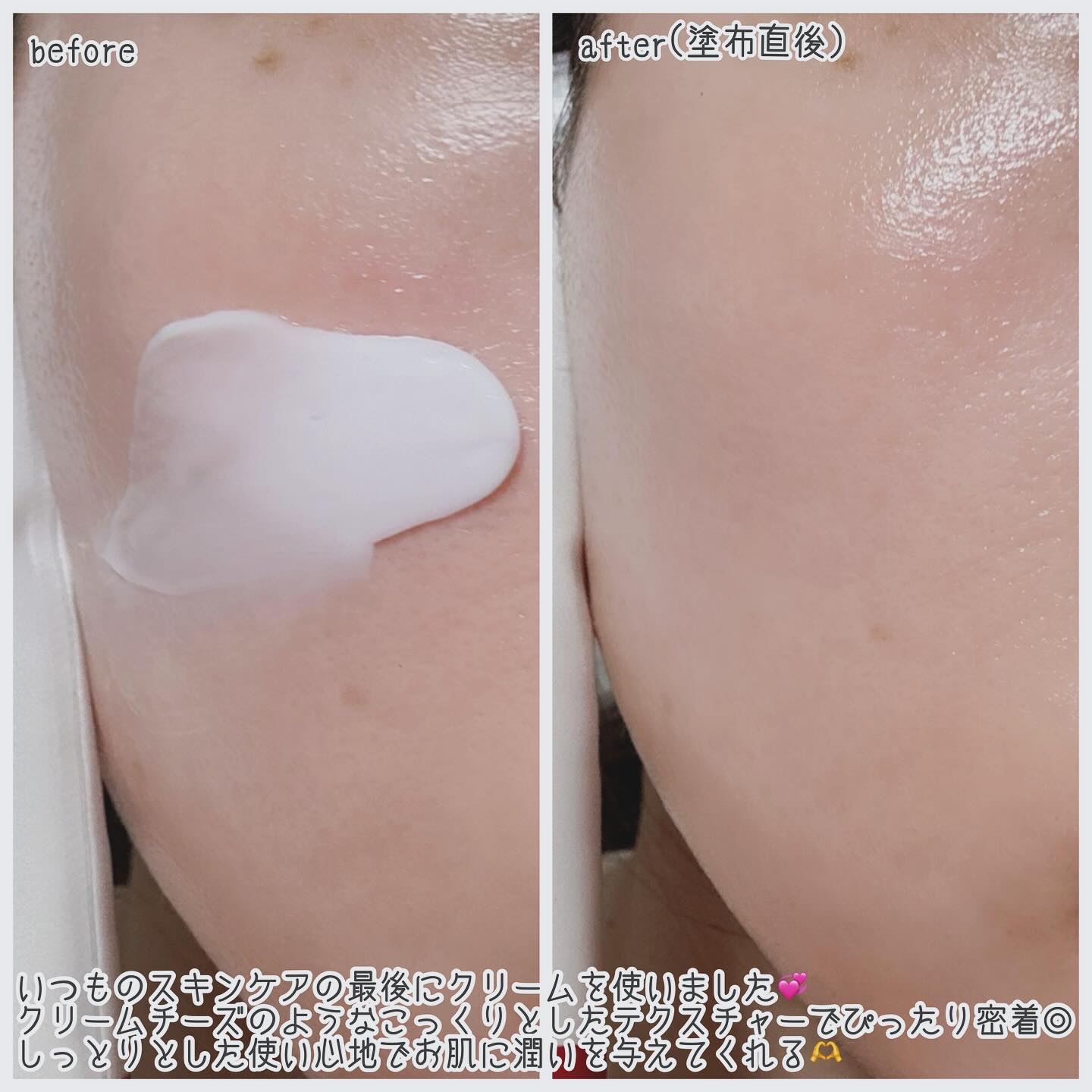 アセロラダークスポット&ブレミッシュ ケア クリーム/RAVIEL/フェイスクリームを使ったクチコミ（3枚目）