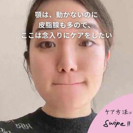 おゆみ|ニキビ・ニキビ跡ケア on LIPS 「@______ohyoume他の投稿【顎下のハリネズミを抹消し..」(4枚目)