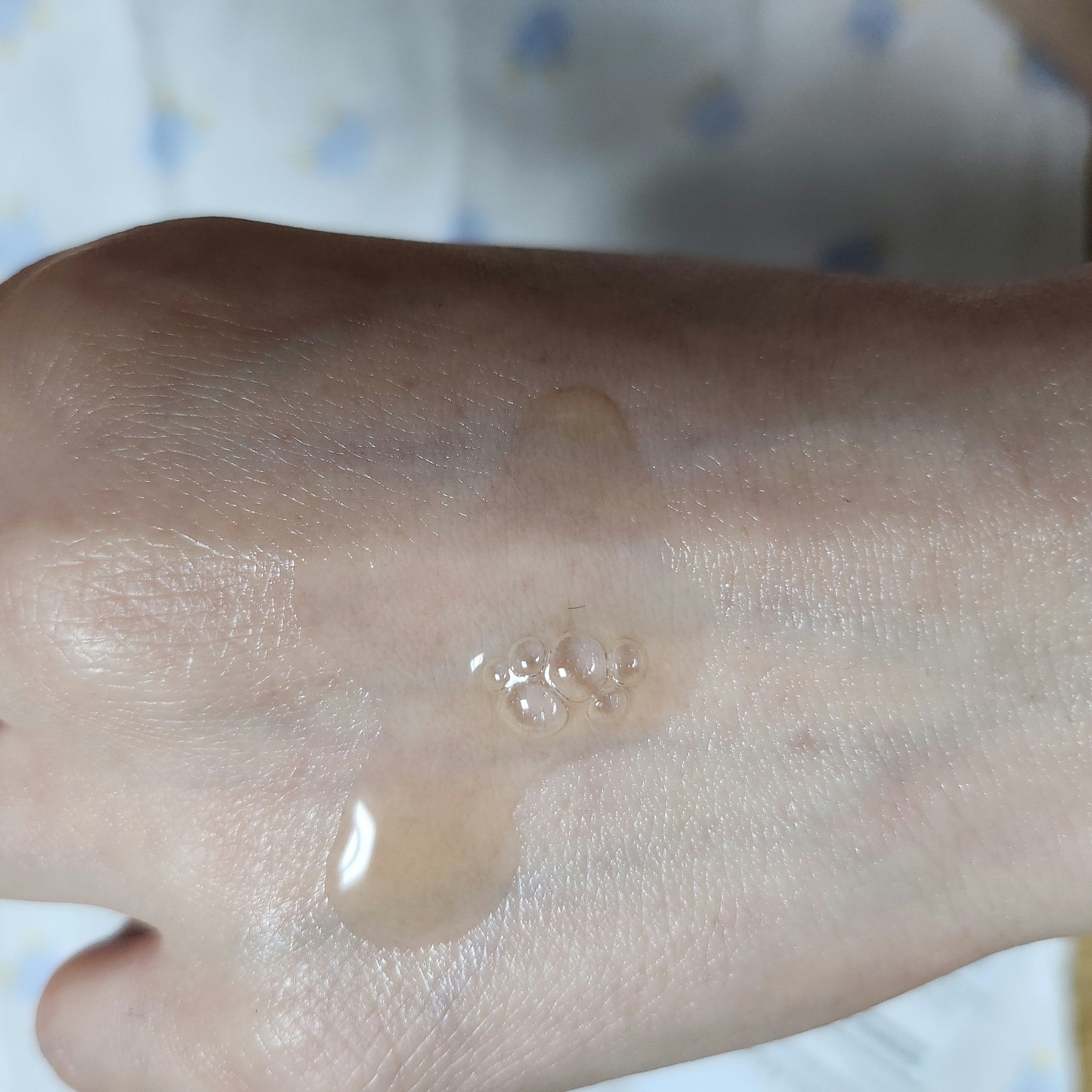 RXザ・アルファアルブチン2 ニキビ跡ケアセラム/COSRX/美容液を使ったクチコミ（2枚目）