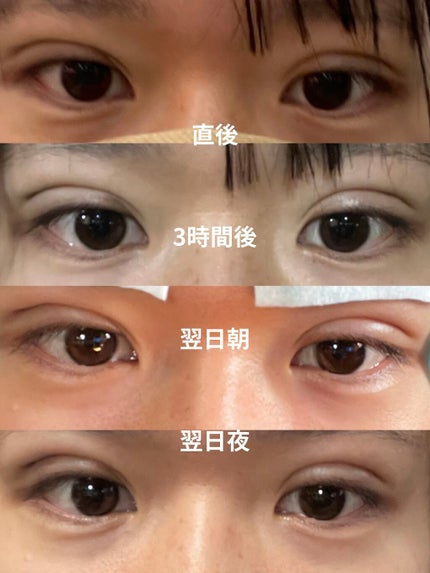 を使ったクチコミ(2枚目)