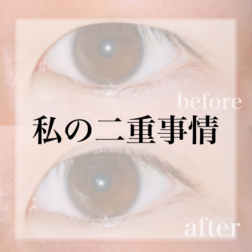 のびるアイテープ/セリア/二重まぶた用アイテムを使ったクチコミ(1枚目)