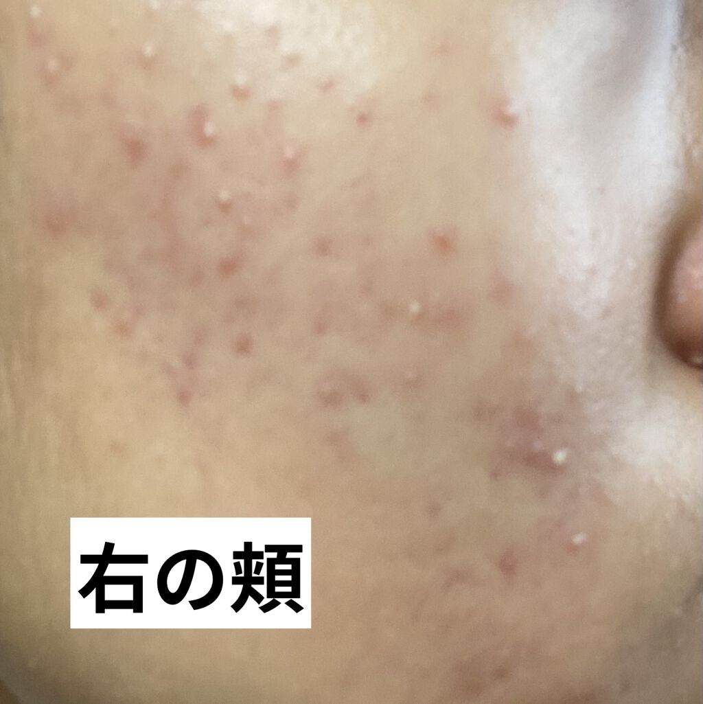 ロゼット洗顔パスタ ホワイトダイヤ/ロゼット/洗顔フォームを使ったクチコミ（2枚目）