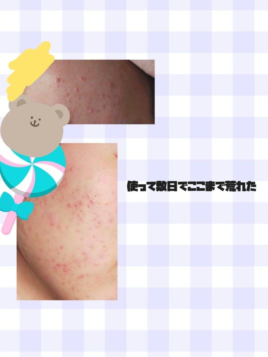 ドクダミ 77 スージングトナー/Anua/化粧水を使ったクチコミ(2枚目)