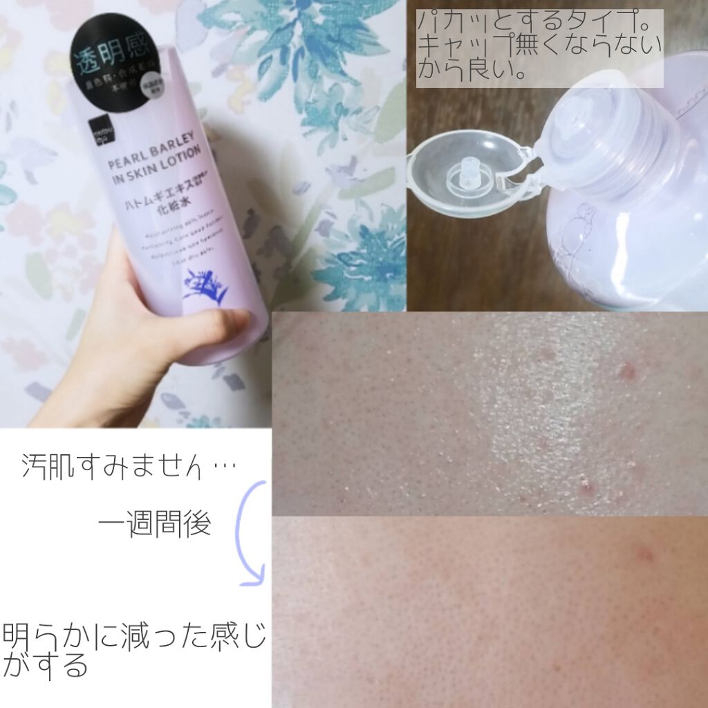 ハトムギ化粧水(ナチュリエ スキンコンディショナー R )/ナチュリエ/化粧水を使ったクチコミ（3枚目）