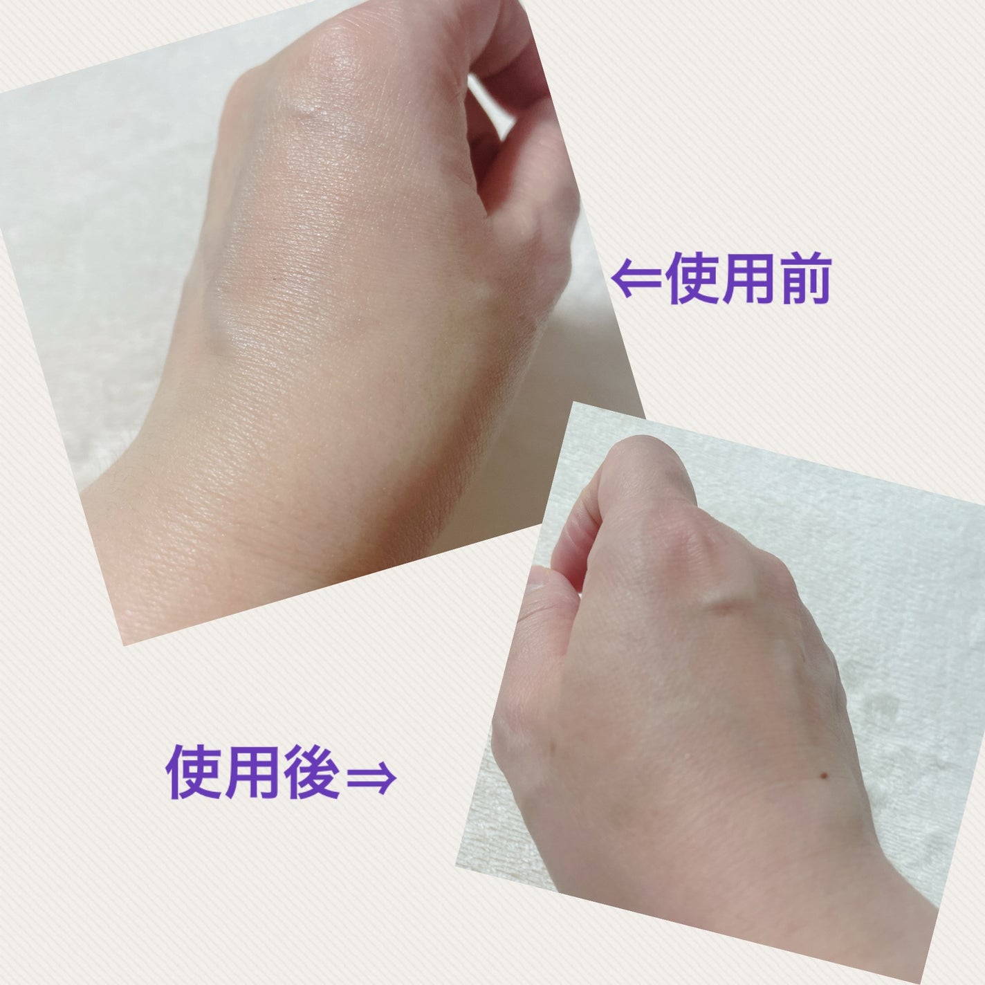 ブラックスネイルレチノールセラム/Dr.G/美容液を使ったクチコミ(3枚目)