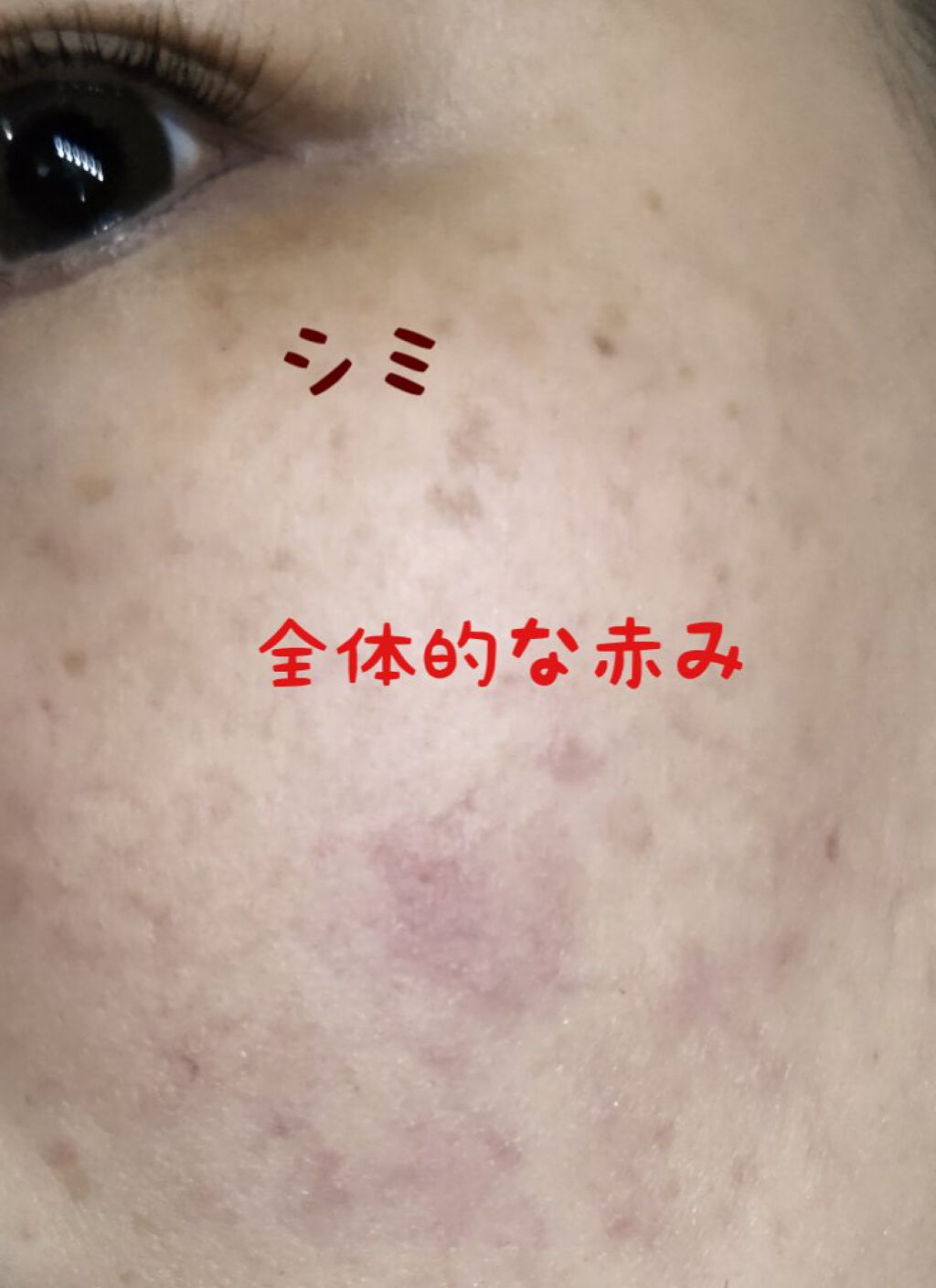 ピンクティーツリーカバークッション/APLIN/クッションファンデーションを使ったクチコミ（3枚目）