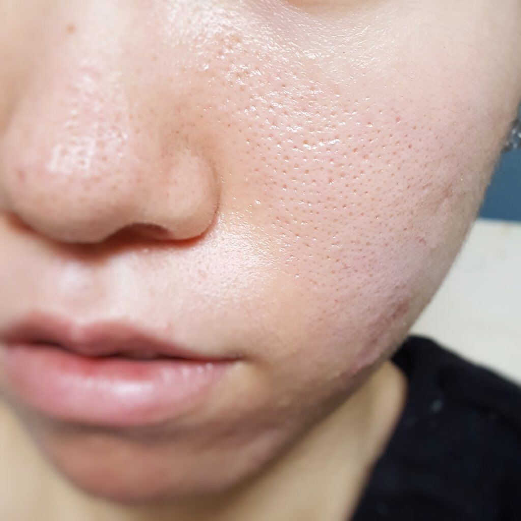 ミネラルカバー薬用美白ファンデセラム/ミリオナ化粧品/美容液を使ったクチコミ(4枚目)