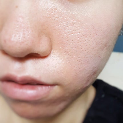 ミネラルカバー薬用美白ファンデセラム/ミリオナ化粧品/美容液を使ったクチコミ(4枚目)