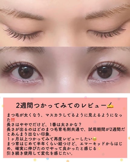 ラッシュアディクト アイラッシュ コンディショニング セラム アドバンス/soaddicted/まつげ美容液を使ったクチコミ(5枚目)