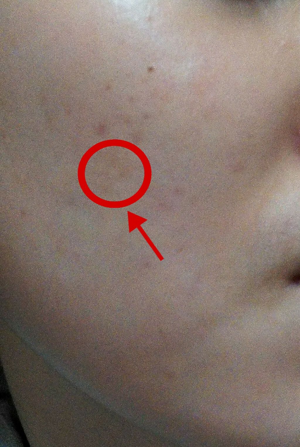 明色美顔水 薬用化粧水/美顔/化粧水を使ったクチコミ(2枚目)