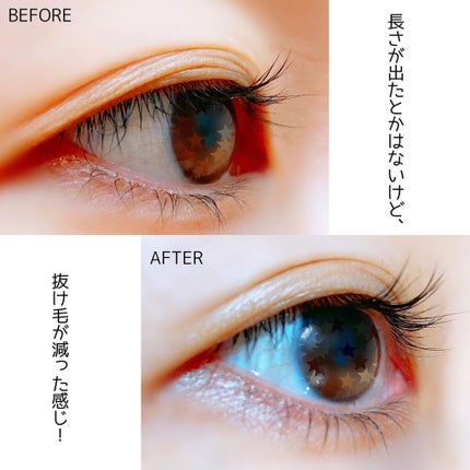 ステムアイラッシュセラム/セルコード/まつげ美容液を使ったクチコミ(7枚目)