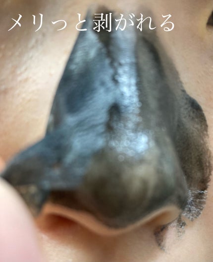 毛穴小町 ブラックピールオフパック/クリアターン/ピーリングを使ったクチコミ(4枚目)
