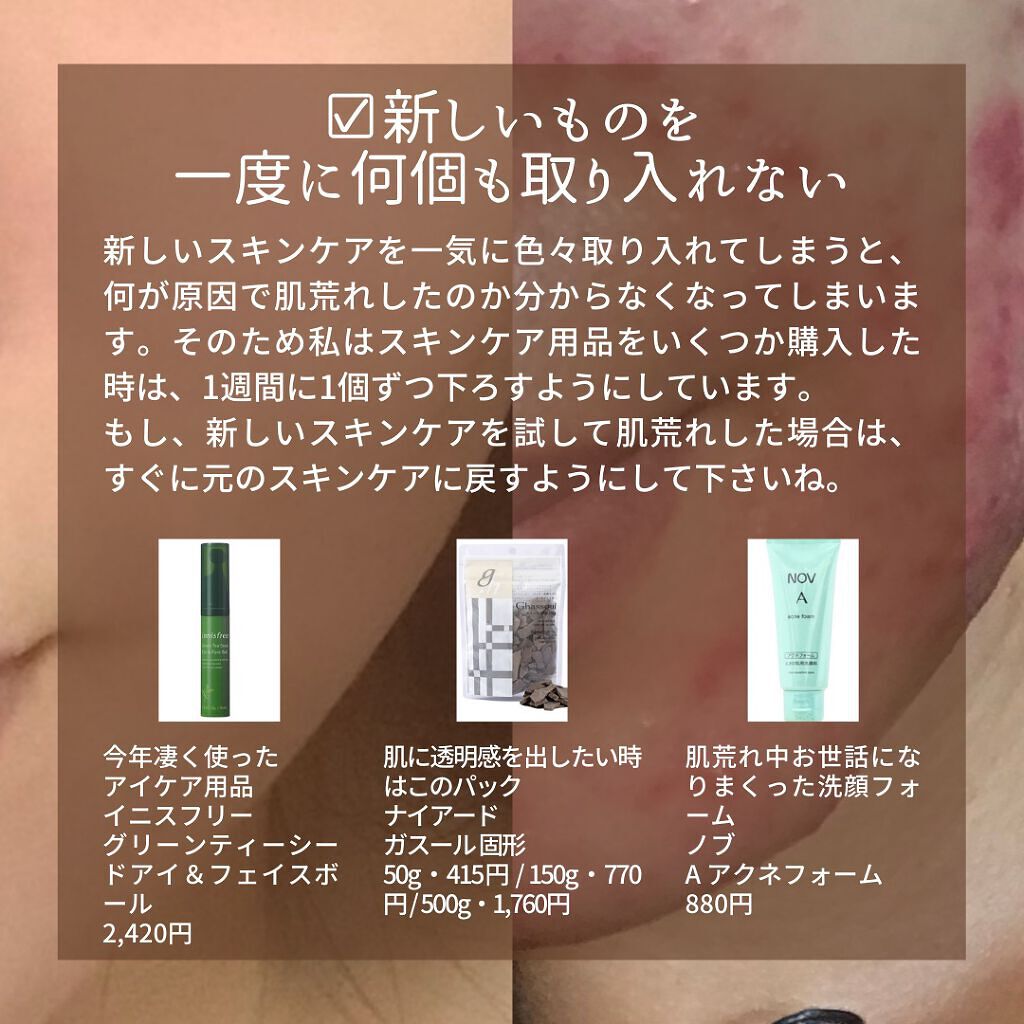 ガスール固形/ナイアード/洗顔石鹸を使ったクチコミ（3枚目）