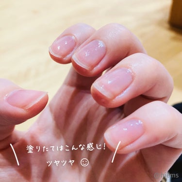 Mimits Moist Nail Serum ミミッツ モイストネイルセラム/ビー・エヌ/ネイルオイル・トリートメントを使ったクチコミ（3枚目）