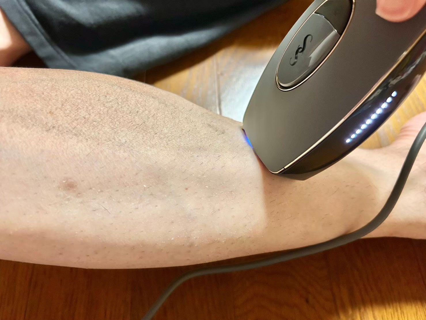 スムーズスキン pure/スムーズスキン/家庭用脱毛器を使ったクチコミ（2枚目）