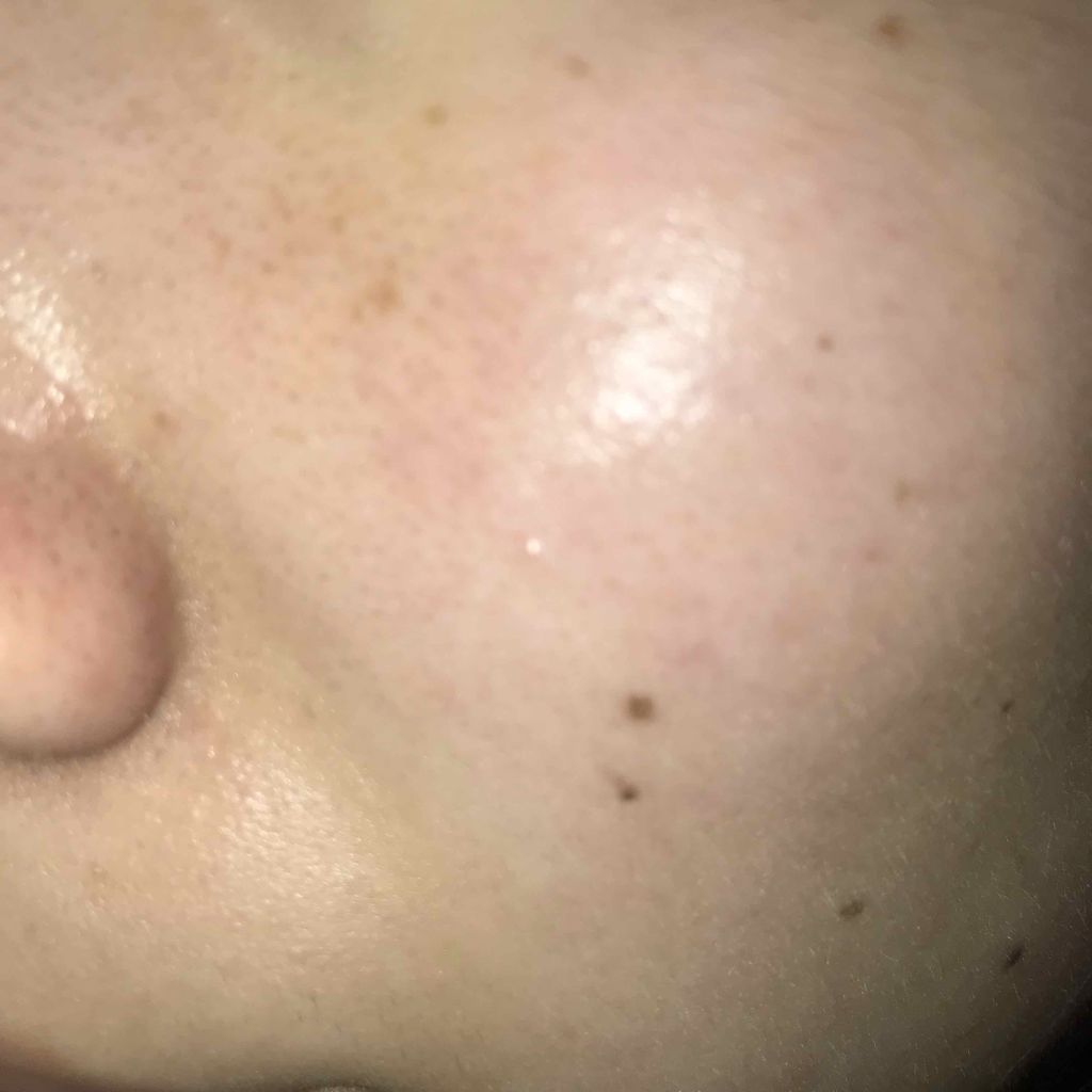 Cセラム/b.glen/美容液を使ったクチコミ（2枚目）