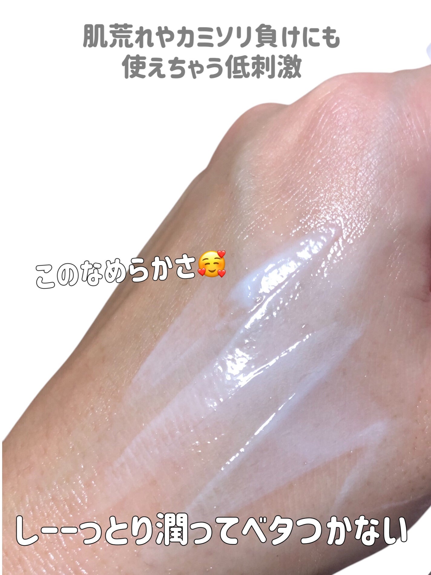 ユースキンシソラ クリーム/ユースキン/ボディクリームを使ったクチコミ(5枚目)