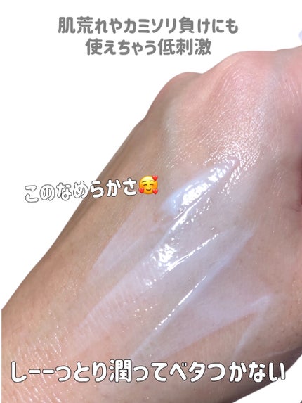 ユースキンシソラ クリーム/ユースキン/ボディクリームを使ったクチコミ(5枚目)