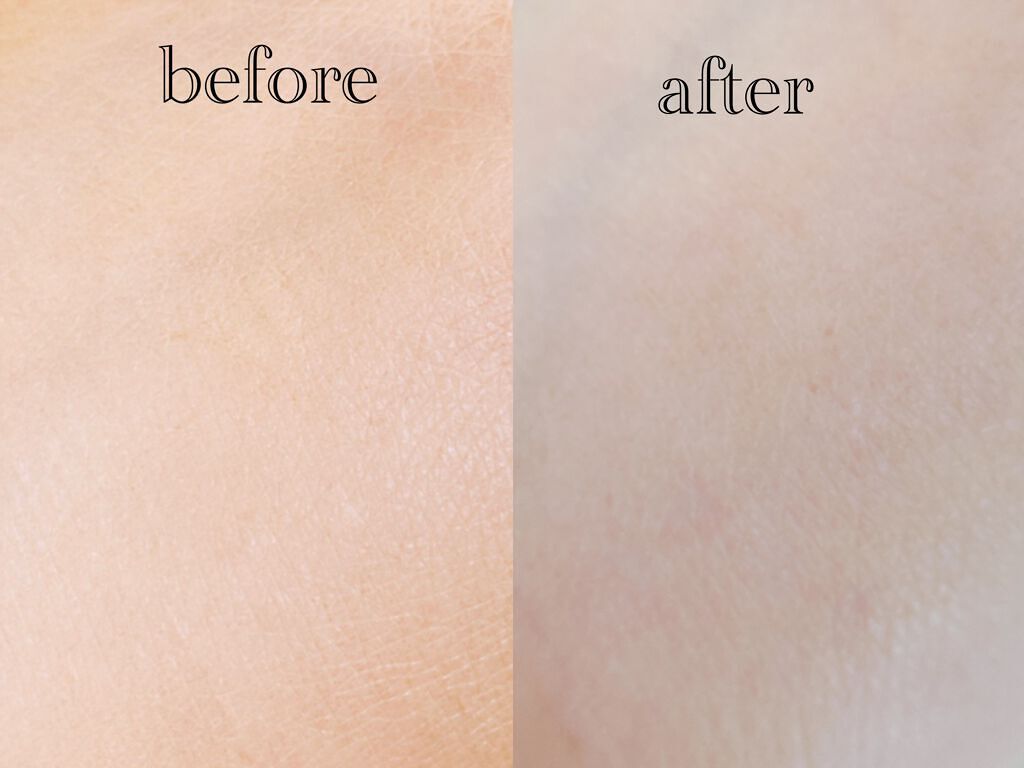 モイスチャーピーリングプロ/Le ment/美顔器・マッサージを使ったクチコミ(7枚目)