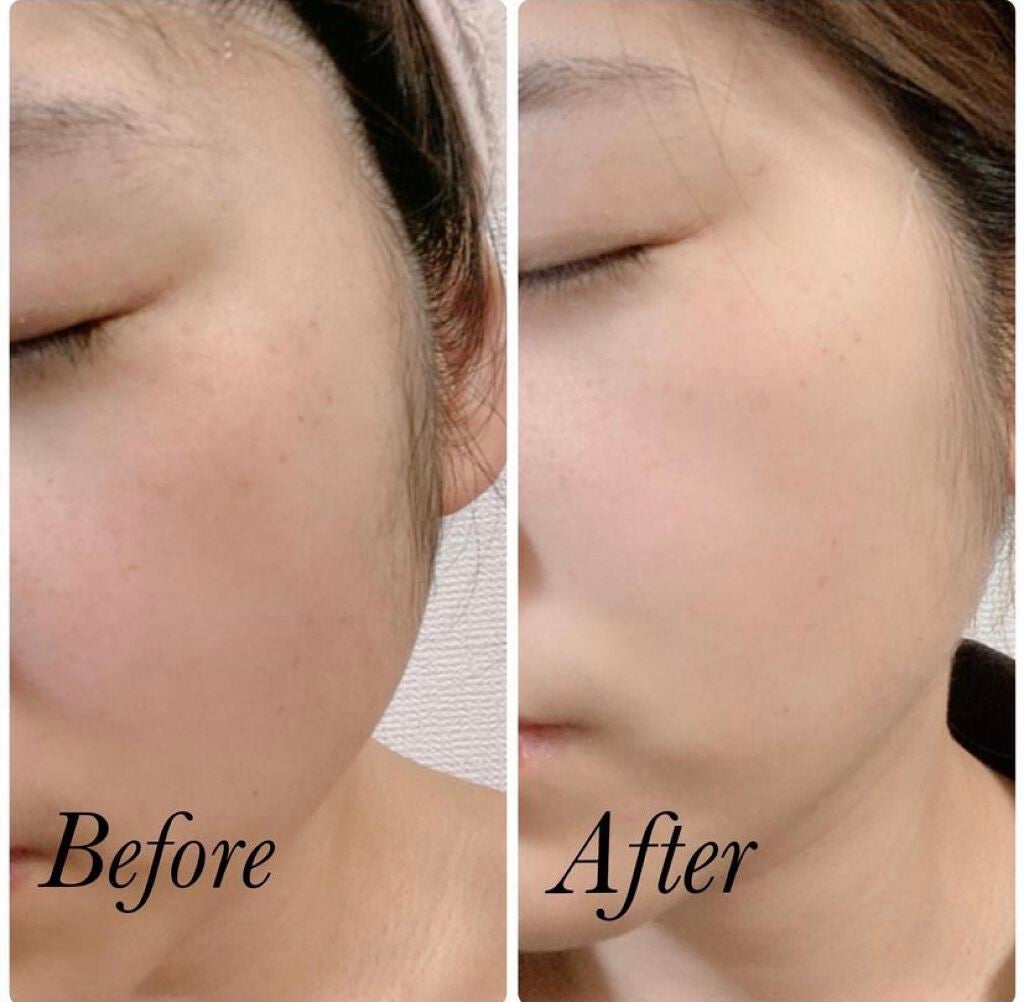 トラネキノールジェル/サンソリット/オールインワン化粧品を使ったクチコミ(6枚目)