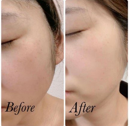 トラネキノールジェル/サンソリット/オールインワン化粧品を使ったクチコミ(6枚目)