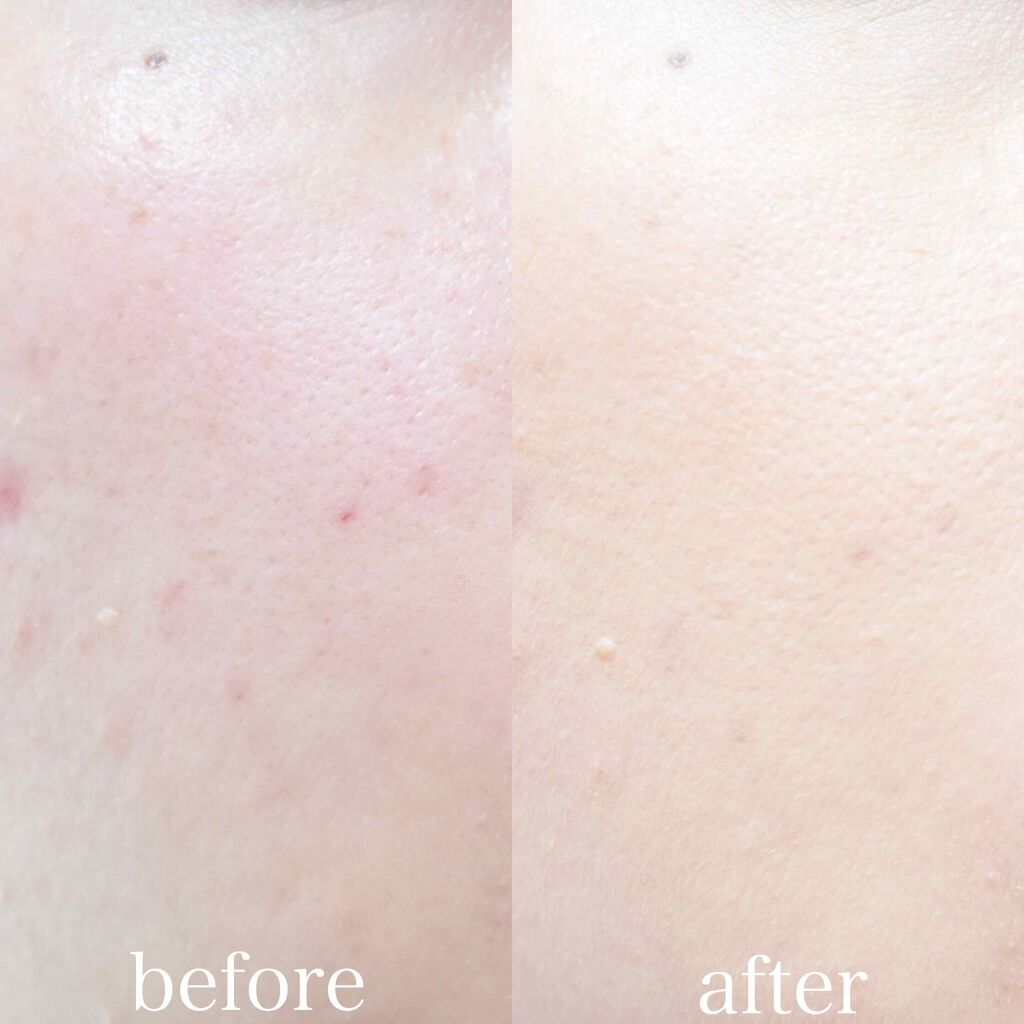 ã·ã³ã¯ããã£ãã ãã¯ã UV/ESPRIQUE/ããŠããŒãã¡ã³ããŒã·ã§ã³ã䜿ã£ãã¯ãã³ãïŒ4æç®ïŒ