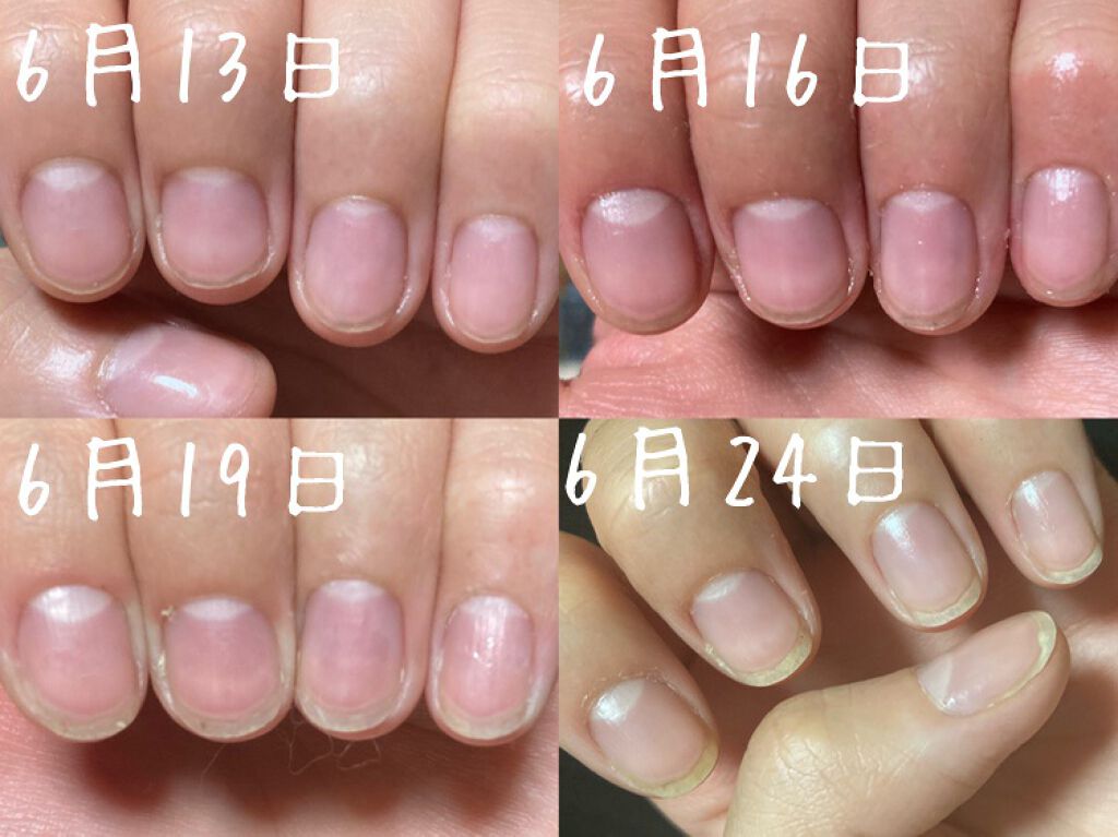 キューティクルオイル/ネイルホリック/ネイルオイル・トリートメントを使ったクチコミ（3枚目）