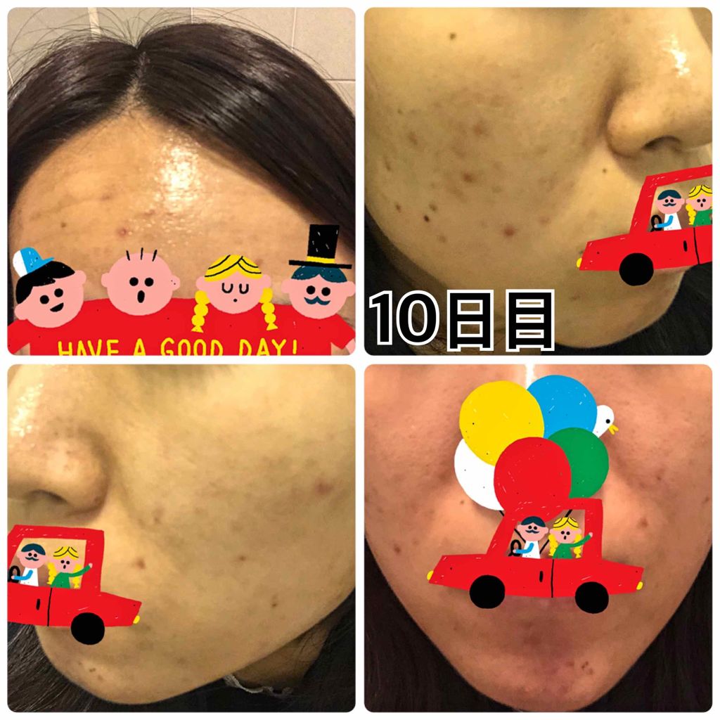 艶肌ドロップ/ラッシュ/美容液を使ったクチコミ(4枚目)