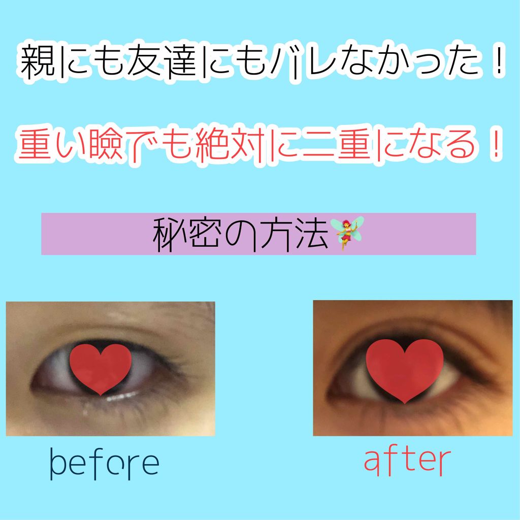 ルドゥーブル/ルドゥーブル/二重まぶた用アイテムを使ったクチコミ(1枚目)