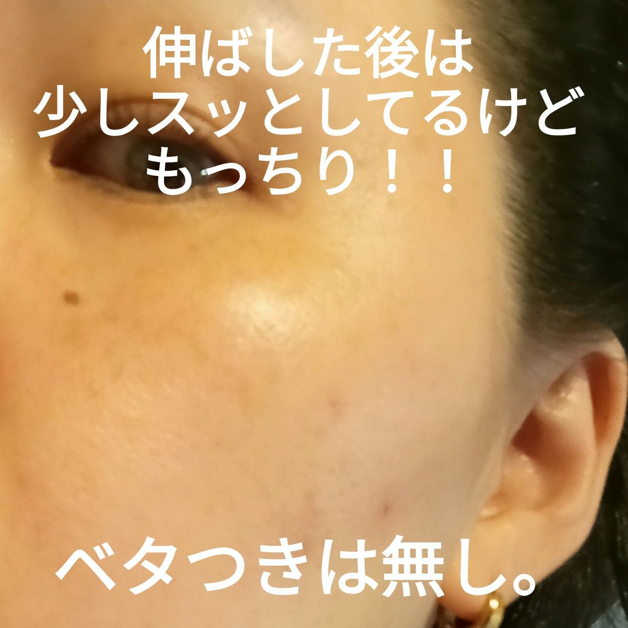 アキュリアルナインコントロールエックスクリーム/ACWELL/フェイスクリームを使ったクチコミ(4枚目)