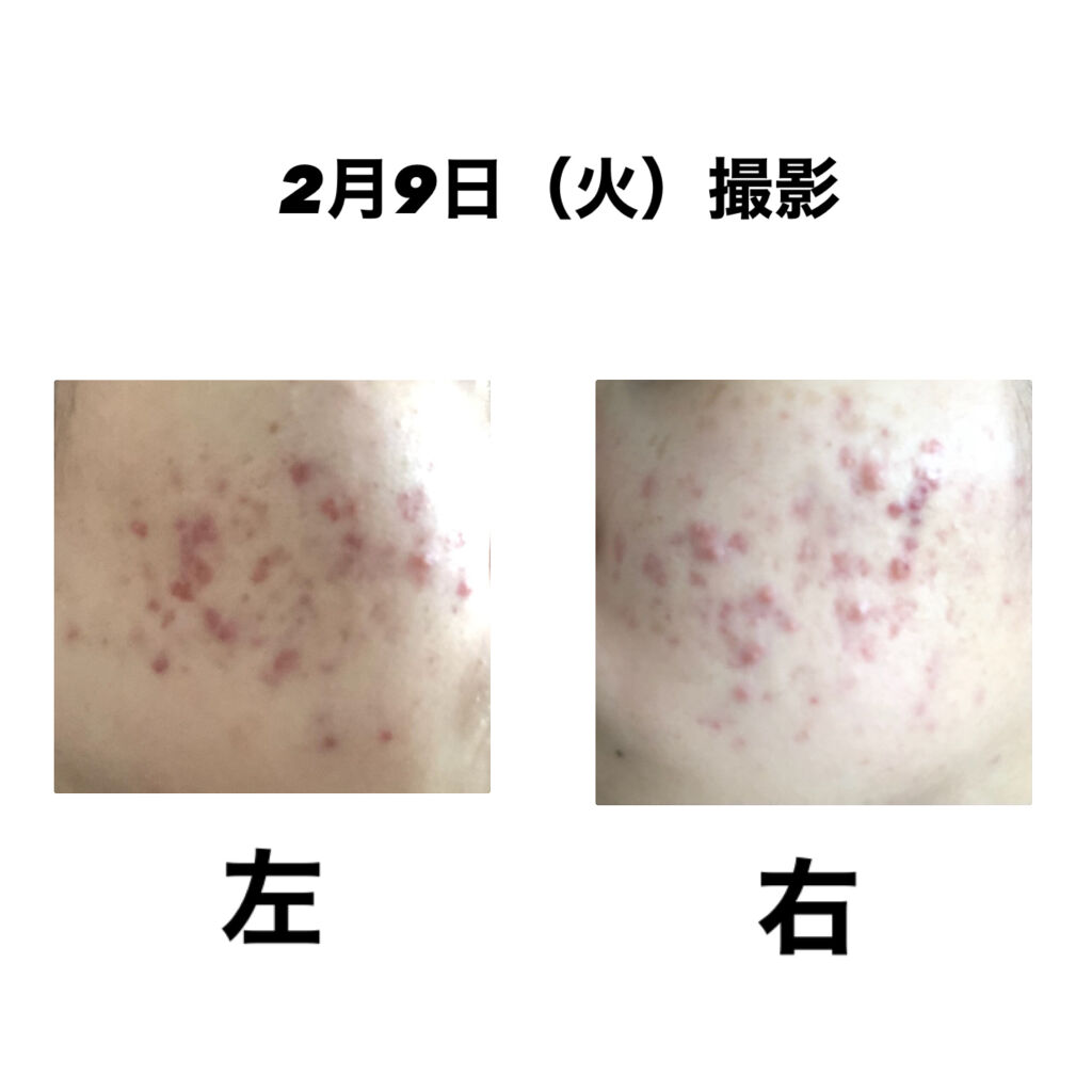 キールズ DS クリアリーブライト エッセンス[医薬部外品]/Kiehl's/美容液を使ったクチコミ（2枚目）