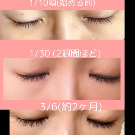 スカルプD ボーテ ピュアフリーアイラッシュセラム プレミアム/アンファー(スカルプD)/まつげ美容液を使ったクチコミ(1枚目)