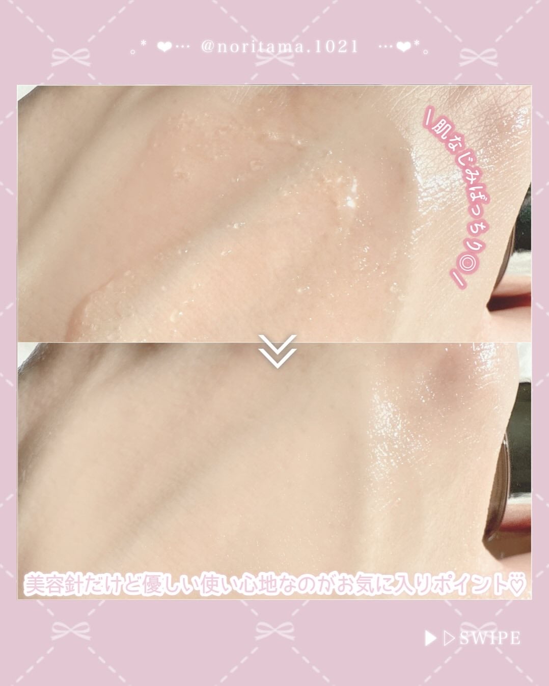 マイクロダーマブースター/XOUL/美容液を使ったクチコミ(4枚目)