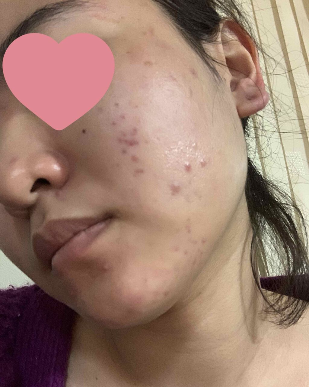 ドクタージャルト シカペア クリーム （第2世代）/Dr.Jart＋/フェイスクリームを使ったクチコミ（2枚目）