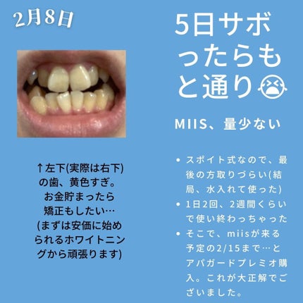 リステリン ホワイトニング/リステリン/マウスウォッシュ・スプレーを使ったクチコミ(3枚目)