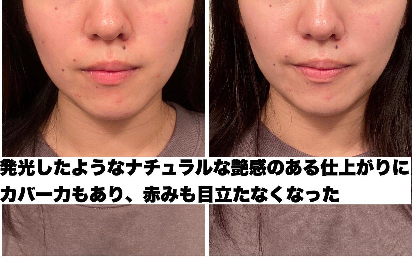 UVã€ã㢠XL ãããã¯ã·ã§ã³ããŒã³ã¢ãã ããŒãº/ã© ããã·ã¥ ããŒ/æ¥çŒãæ¢ãã¯ãªãŒã ã䜿ã£ãã¯ãã³ãïŒ6æç®ïŒ