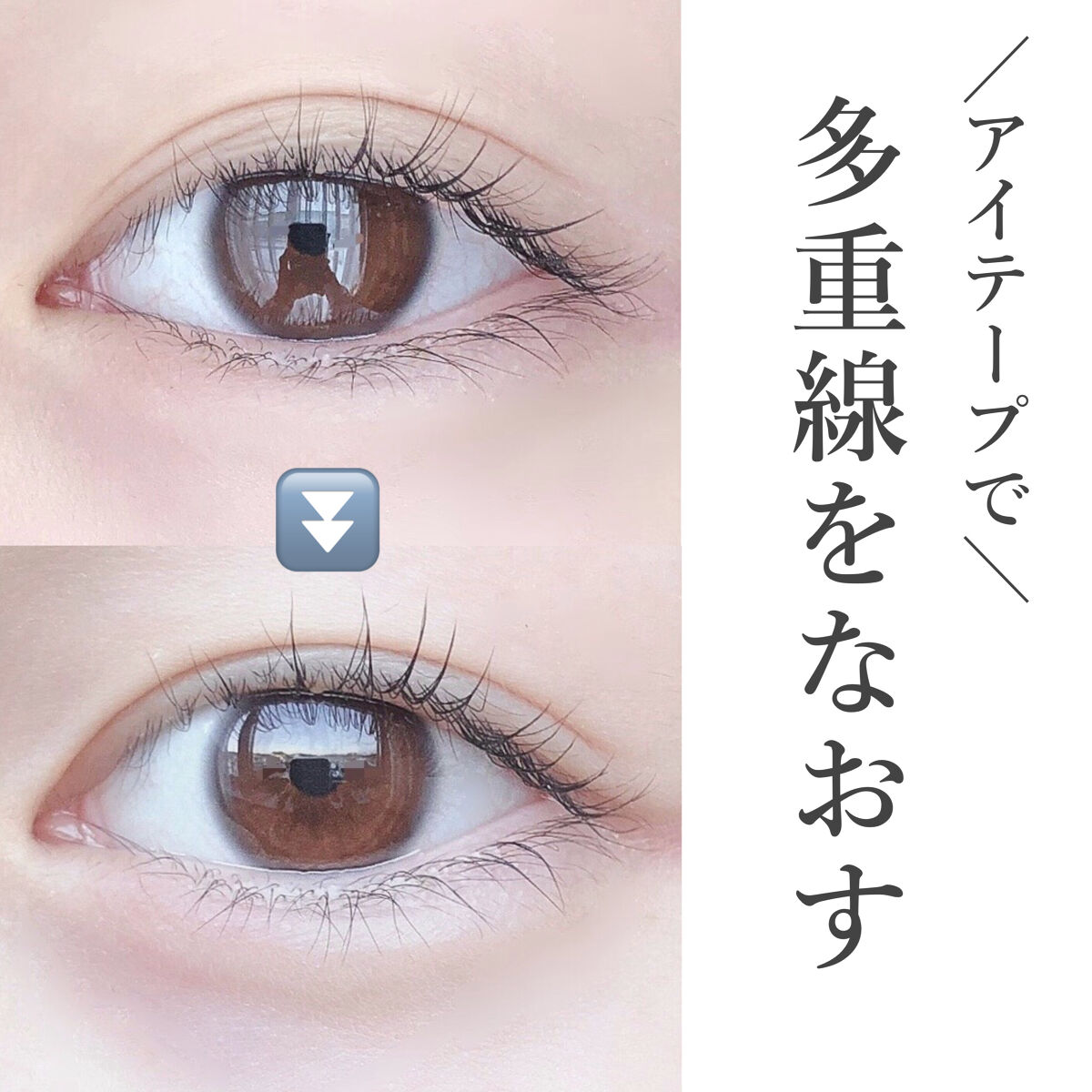 のびーるアイテープ（絆創膏タイプ、レギュラー）/DAISO/二重まぶた用アイテムを使ったクチコミ（1枚目）