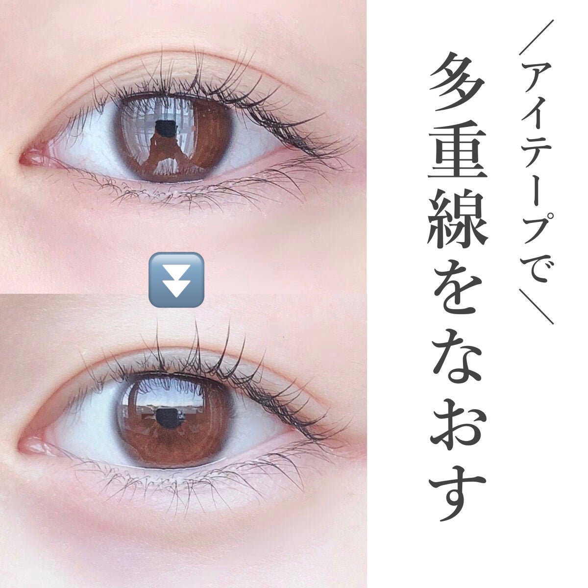 のびーるアイテープ(絆創膏タイプ、レギュラー)/DAISO/二重まぶた用アイテムを使ったクチコミ(1枚目)