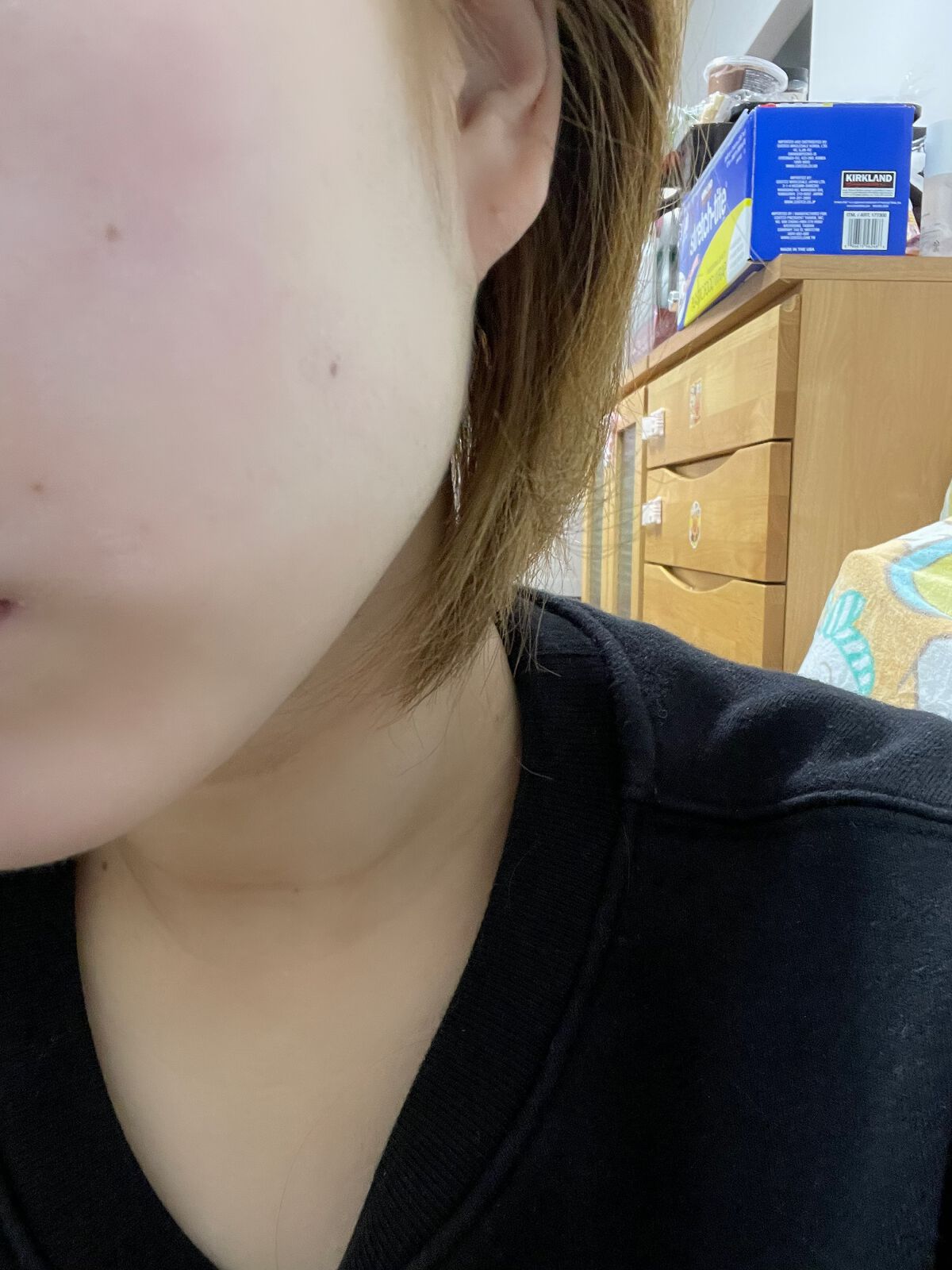 デュイセル ターンオンクリーム/DEWYCEL/フェイスクリームを使ったクチコミ(4枚目)