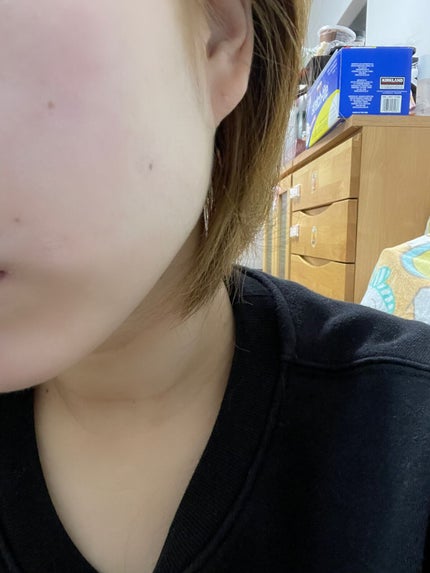 デュイセル ターンオンクリーム/DEWYCEL/フェイスクリームを使ったクチコミ(4枚目)