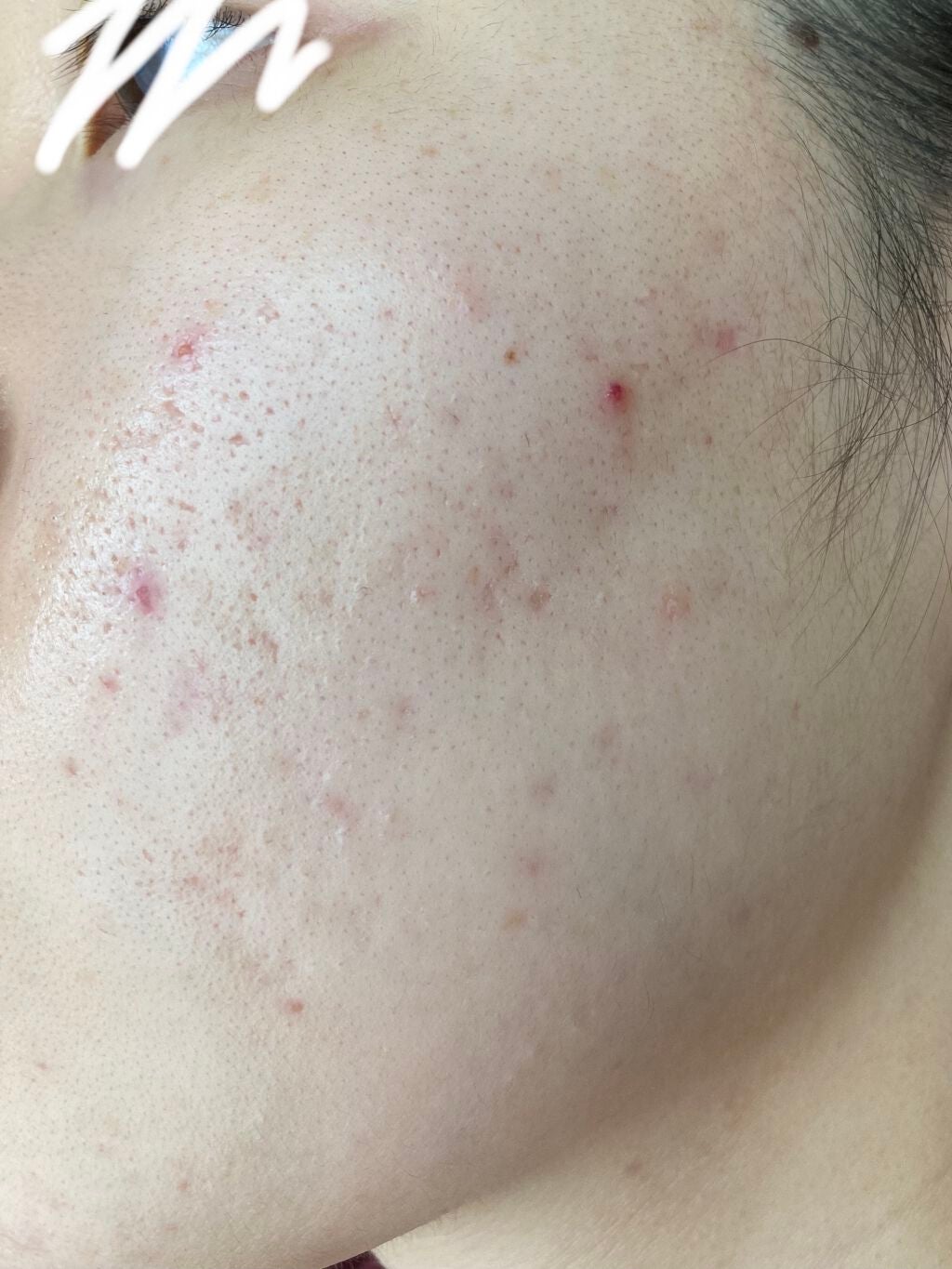 モイスチャージェル2/エンビロン/フェイスクリームを使ったクチコミ(3枚目)