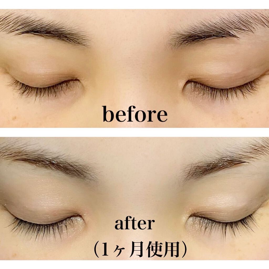 アイリッドセラム/Bamiru/まつげ美容液を使ったクチコミ(3枚目)