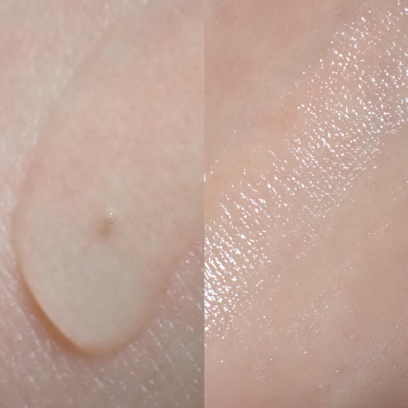 BP-PORE AMPOULE /Dr.Melaxin/美容液を使ったクチコミ(6枚目)